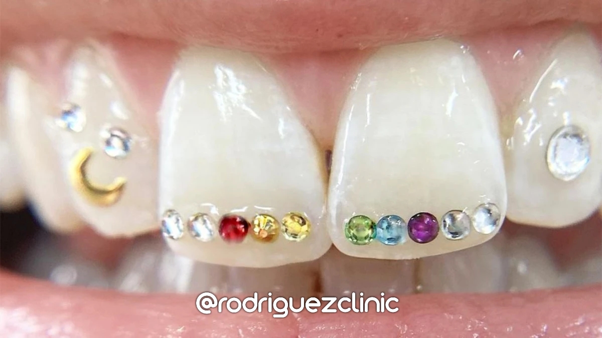 Tipos de Gemas Dentales: ¿Cuál es la Adecuada para Ti? – holygemzzz