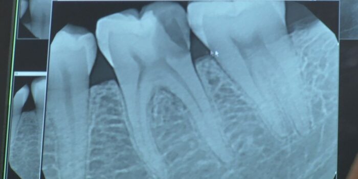 Radiografía Dental Digital